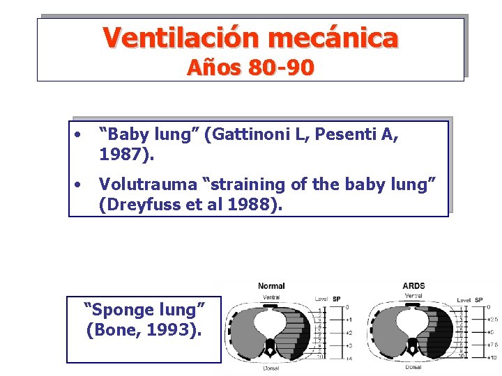 Ventilación mecánica Años 80 -90 • “Baby lung” (Gattinoni L, Pesenti A, 1987). •