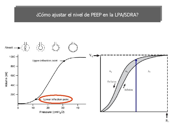 ¿Cómo ajustar el nivel de PEEP en la LPA/SDRA? 