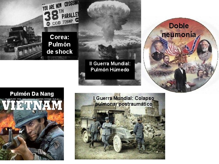 Doble neumonía Corea: Pulmón de shock II Guerra Mundial: Pulmón Húmedo Pulmón Nang Pulmón