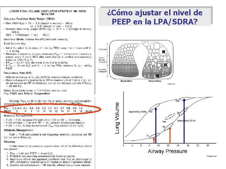 ¿Cómo ajustar el nivel de PEEP en la LPA/SDRA? 