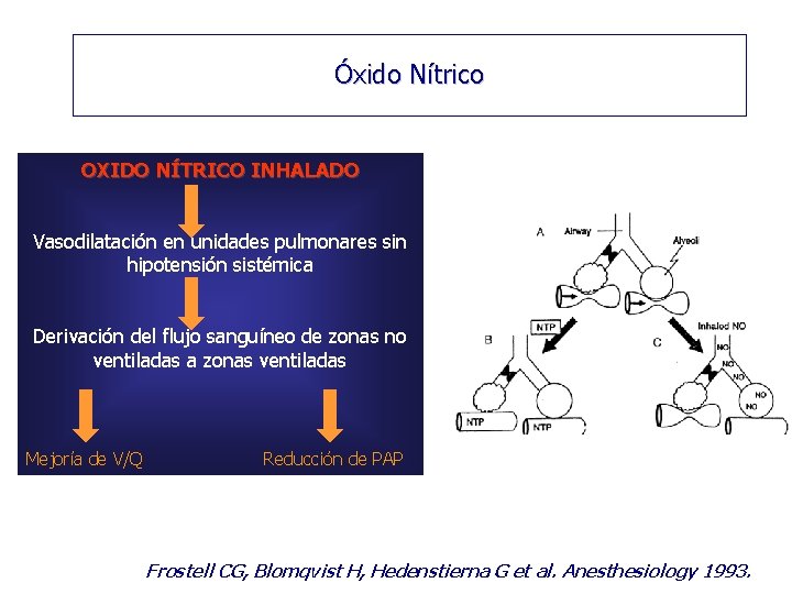 Óxido Nítrico OXIDO NÍTRICO INHALADO Vasodilatación en unidades pulmonares sin hipotensión sistémica Derivación del