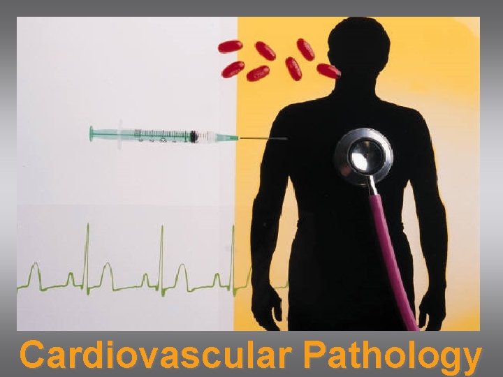 Cardiovascular Pathology 