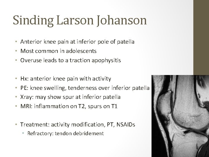 Sinding Larson Johanson • Anterior knee pain at inferior pole of patella • Most