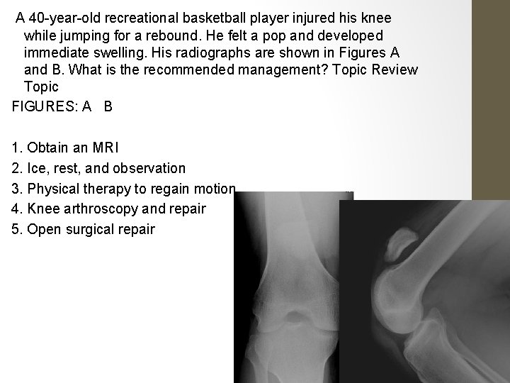 A 40 -year-old recreational basketball player injured his knee while jumping for a rebound.