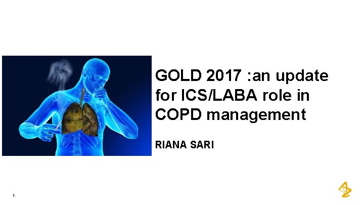 GOLD 2017 : an update for ICS/LABA role in COPD management RIANA SARI 1