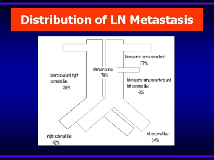 Distribution of LN Metastasis 