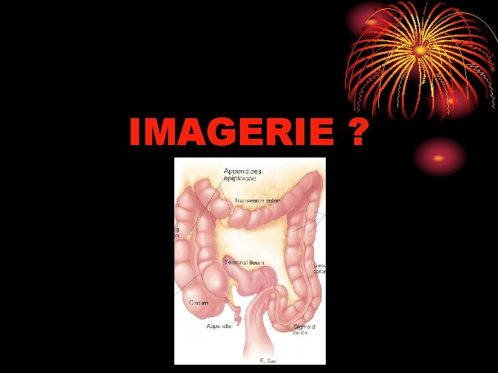 IMAGERIE ? 