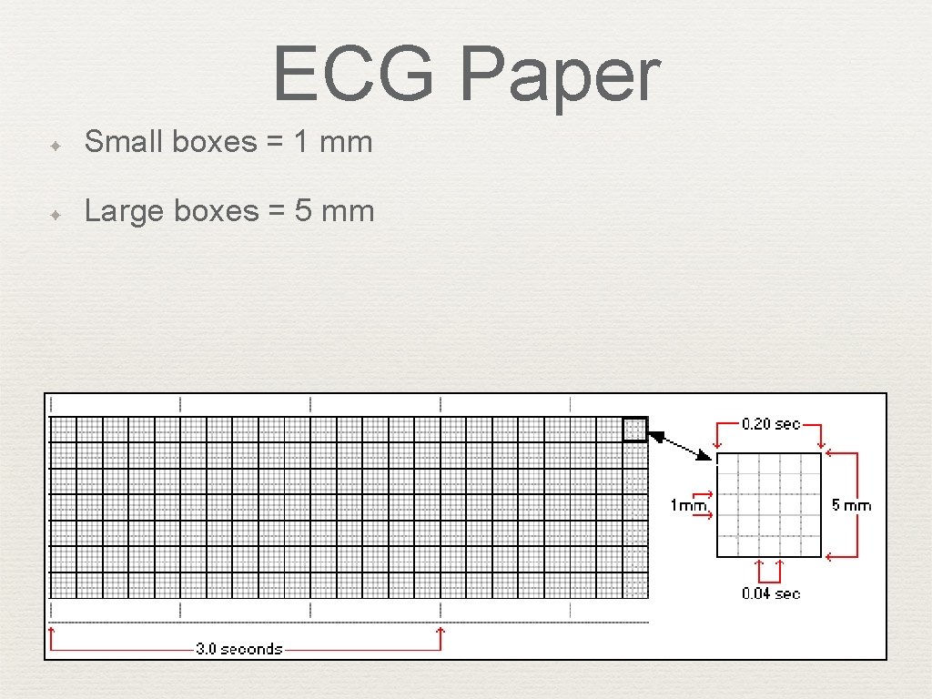 ECG Paper ✦ Small boxes = 1 mm ✦ Large boxes = 5 mm