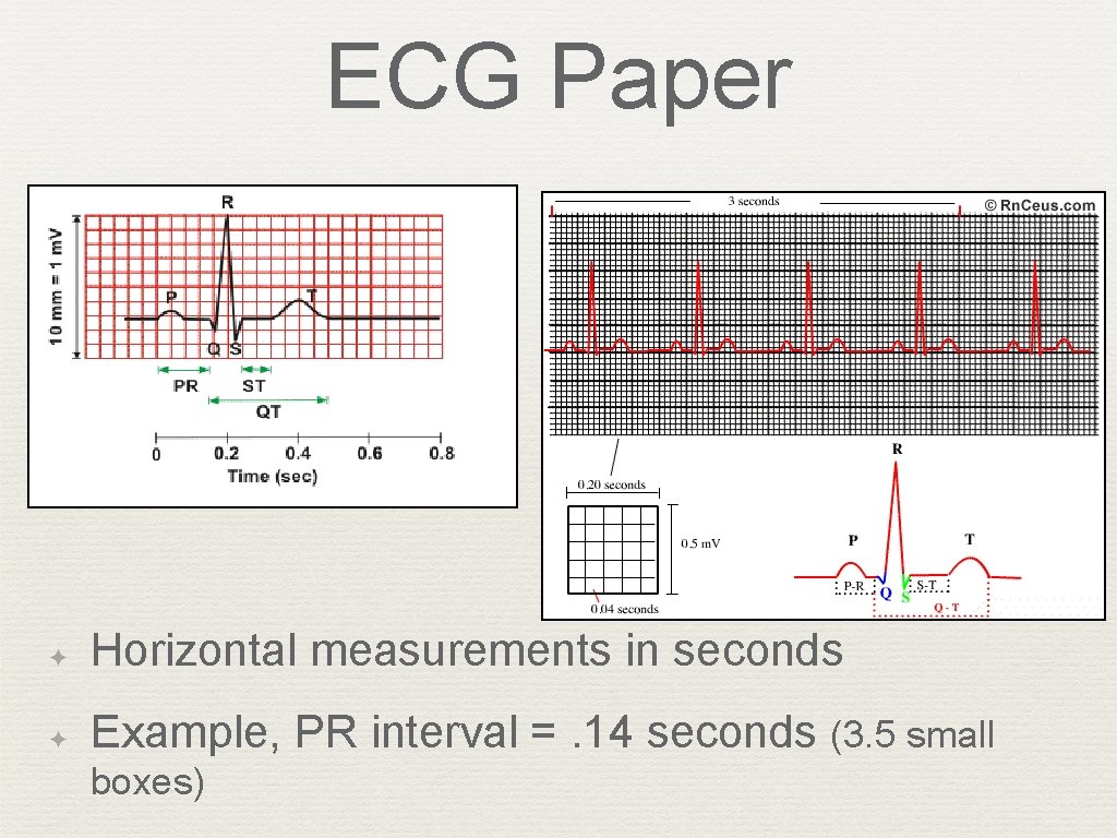 ECG Paper ✦ Horizontal measurements in seconds ✦ Example, PR interval =. 14 seconds