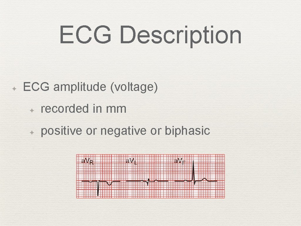 ECG Description ✦ ECG amplitude (voltage) ✦ recorded in mm ✦ positive or negative