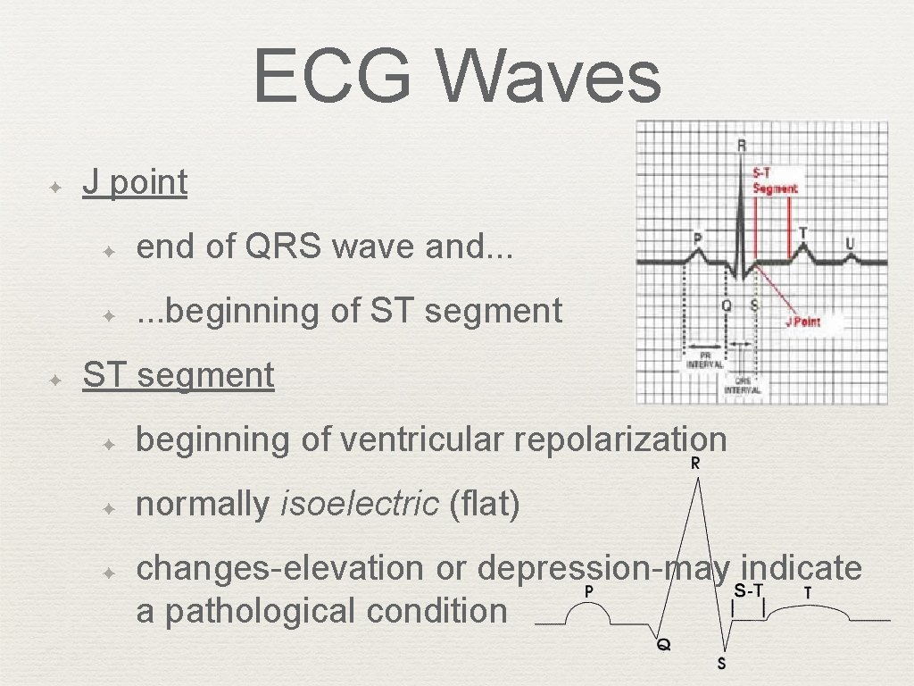 ECG Waves ✦ ✦ J point ✦ end of QRS wave and. . .