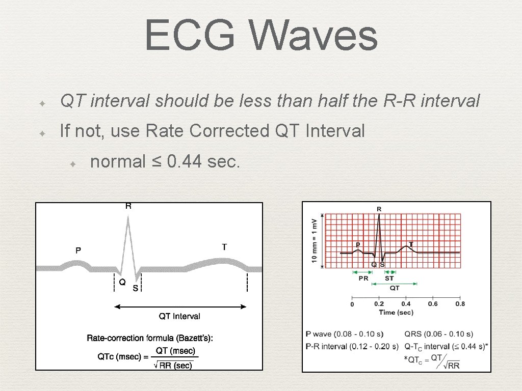 ECG Waves ✦ QT interval should be less than half the R-R interval ✦