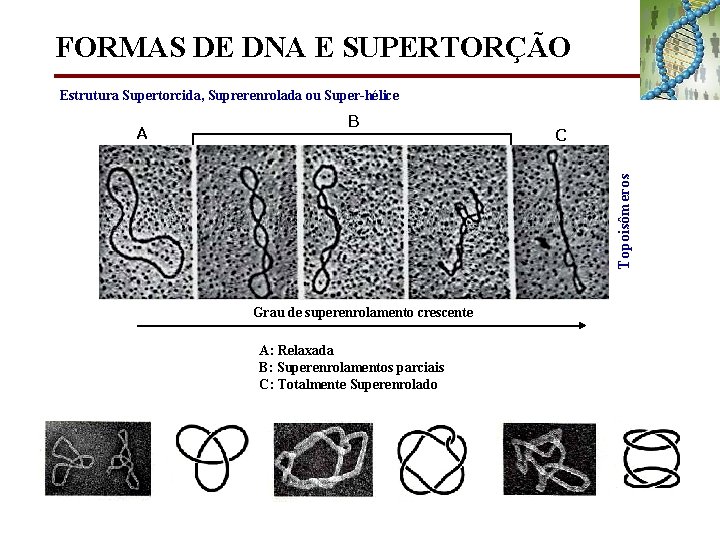 FORMAS DE DNA E SUPERTORÇÃO Estrutura Supertorcida, Suprerenrolada ou Super-hélice B C Topoisômeros A
