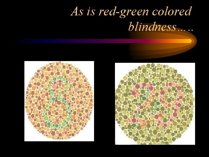 As is red-green colored blindness…. . 