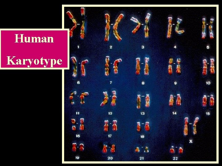 Human Karyotype 