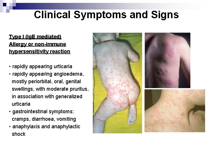 Clinical Symptoms and Signs Type I (Ig. E mediated) Allergy or non-immune hypersensitivity reaction
