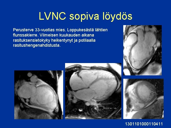 LVNC sopiva löydös Perusterve 33 -vuotias mies. Loppukesästä lähtien flunssakierre. Viimeisen kuukauden aikana rasituksensietokyky