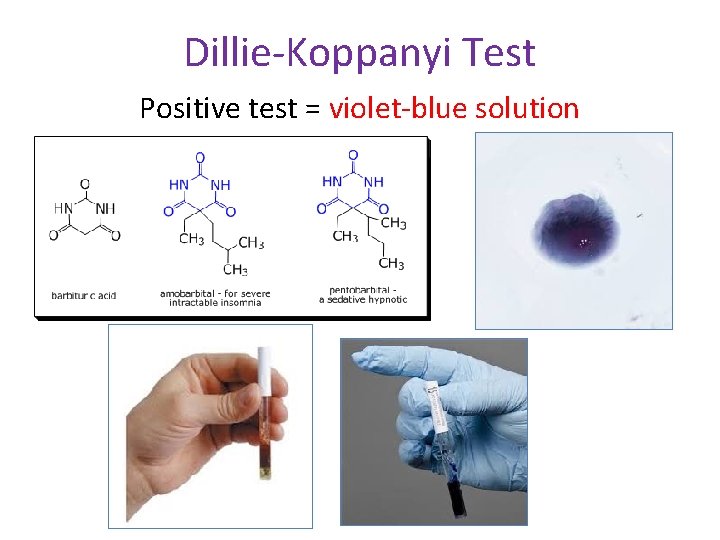 Dillie-Koppanyi Test Positive test = violet-blue solution 