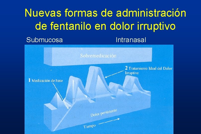 Nuevas formas de administración de fentanilo en dolor irruptivo Submucosa Intranasal Nuevas formas de administración de fentanilo en dolor irruptivo Submucosa Intranasal