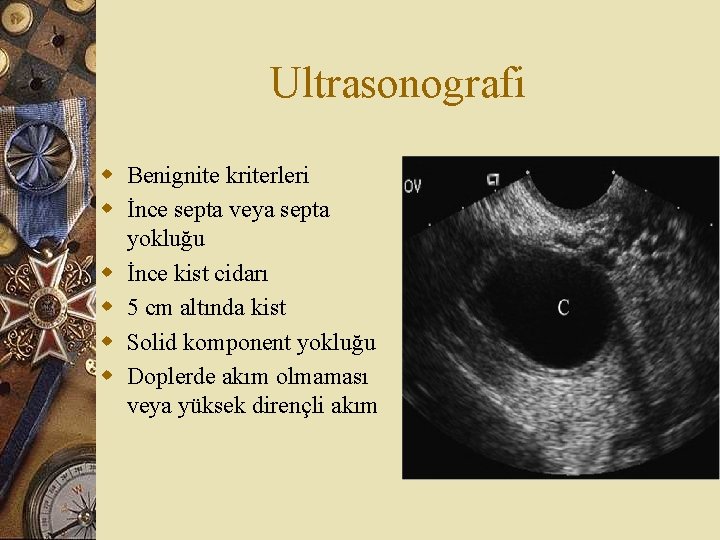 Ultrasonografi w Benignite kriterleri w İnce septa veya septa yokluğu w İnce kist cidarı