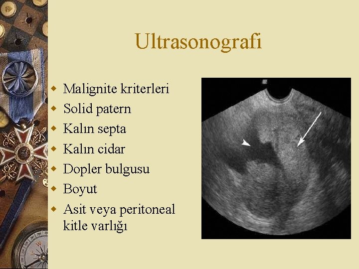 Ultrasonografi w w w w Malignite kriterleri Solid patern Kalın septa Kalın cidar Dopler