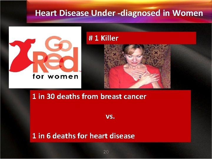 Heart Disease Under -diagnosed in Women # 1 Killer 1 in 30 deaths from