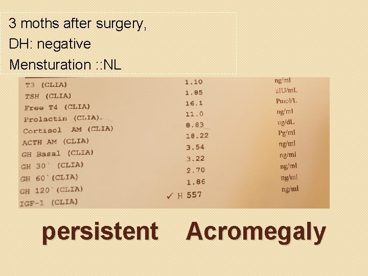 3 moths after surgery, DH: negative Mensturation : : NL persistent Acromegaly 