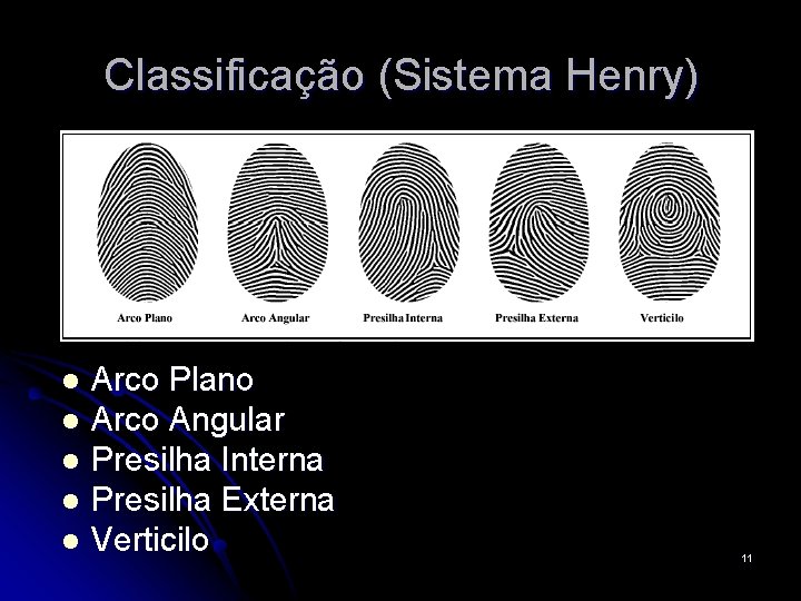 Classificação (Sistema Henry) Arco Plano l Arco Angular l Presilha Interna l Presilha Externa