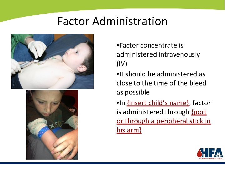Factor Administration • Factor concentrate is administered intravenously (IV) • It should be administered