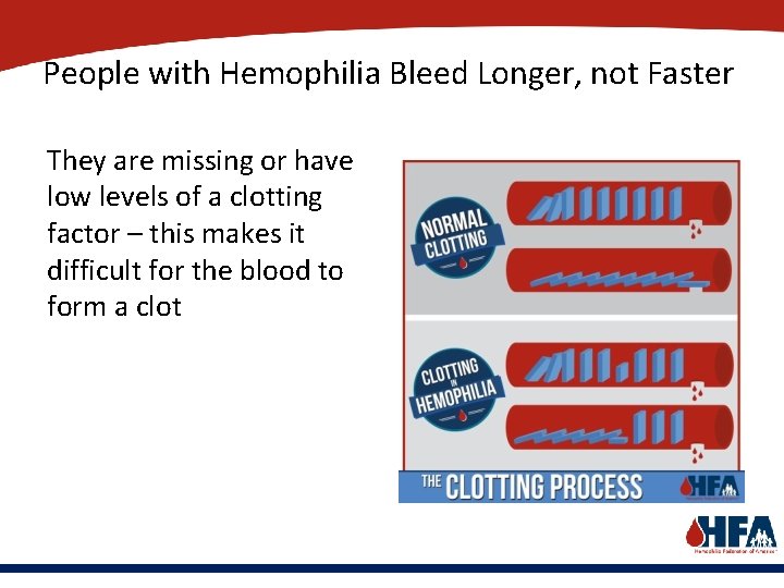 People with Hemophilia Bleed Longer, not Faster They are missing or have low levels