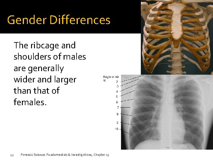 Gender Differences The ribcage and shoulders of males are generally wider and larger than Gender Differences The ribcage and shoulders of males are generally wider and larger than