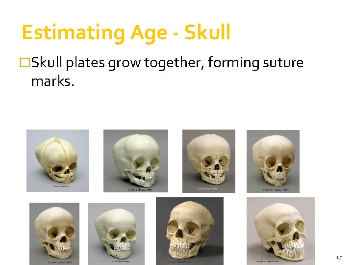 Estimating Age - Skull �Skull plates grow together, forming suture marks. 15 Estimating Age - Skull �Skull plates grow together, forming suture marks. 15