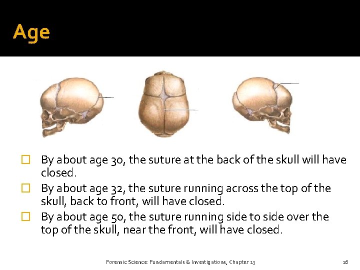 Age � By about age 30, the suture at the back of the skull Age � By about age 30, the suture at the back of the skull