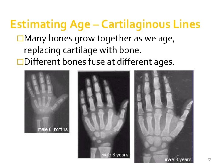 Estimating Age – Cartilaginous Lines �Many bones grow together as we age, replacing cartilage Estimating Age – Cartilaginous Lines �Many bones grow together as we age, replacing cartilage