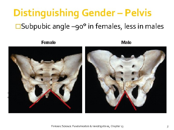 Distinguishing Gender – Pelvis �Subpubic angle – 90° in females, less in males Forensic Distinguishing Gender – Pelvis �Subpubic angle – 90° in females, less in males Forensic