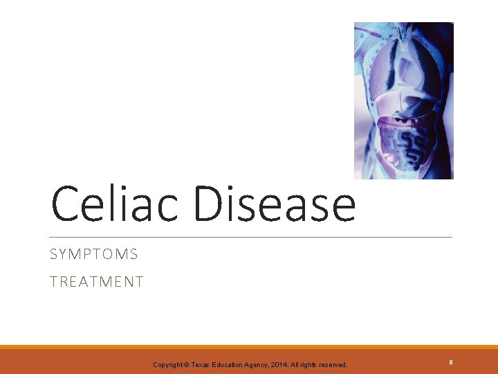 Celiac Disease SYMPTOMS TREATMENT Copyright © Texas Education Agency, 2014. All rights reserved. 8