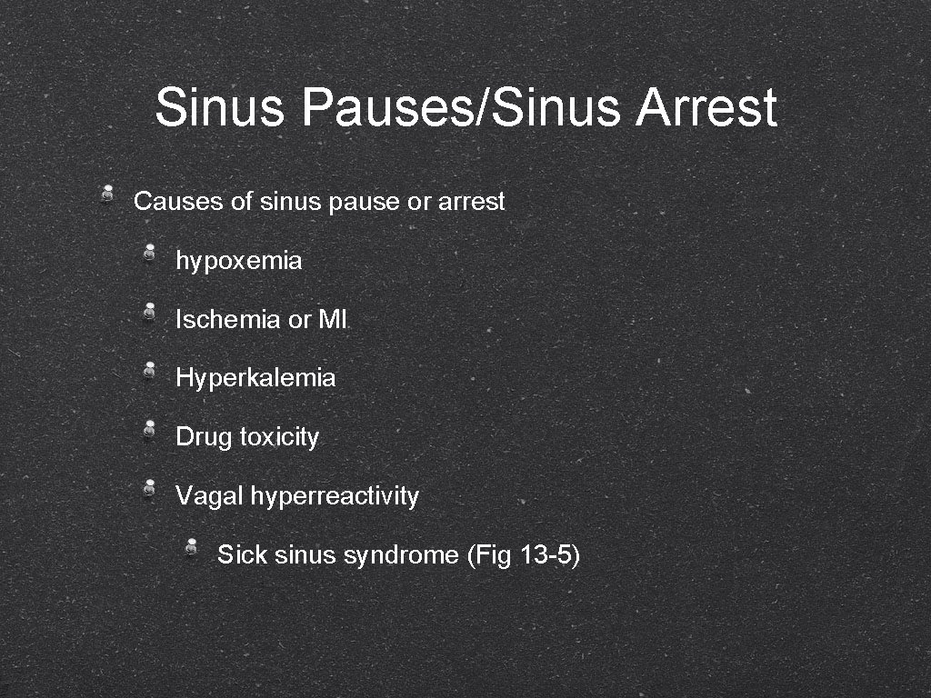 Sinus Pauses/Sinus Arrest Causes of sinus pause or arrest hypoxemia Ischemia or MI Hyperkalemia