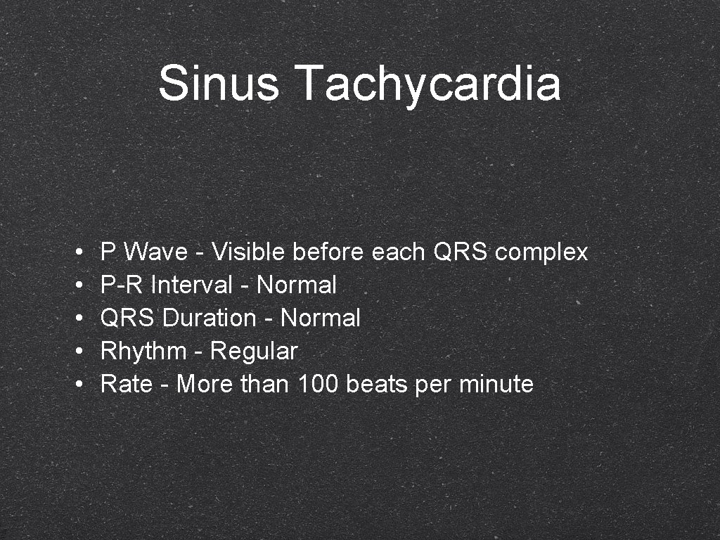 Sinus Tachycardia • • • P Wave - Visible before each QRS complex P-R