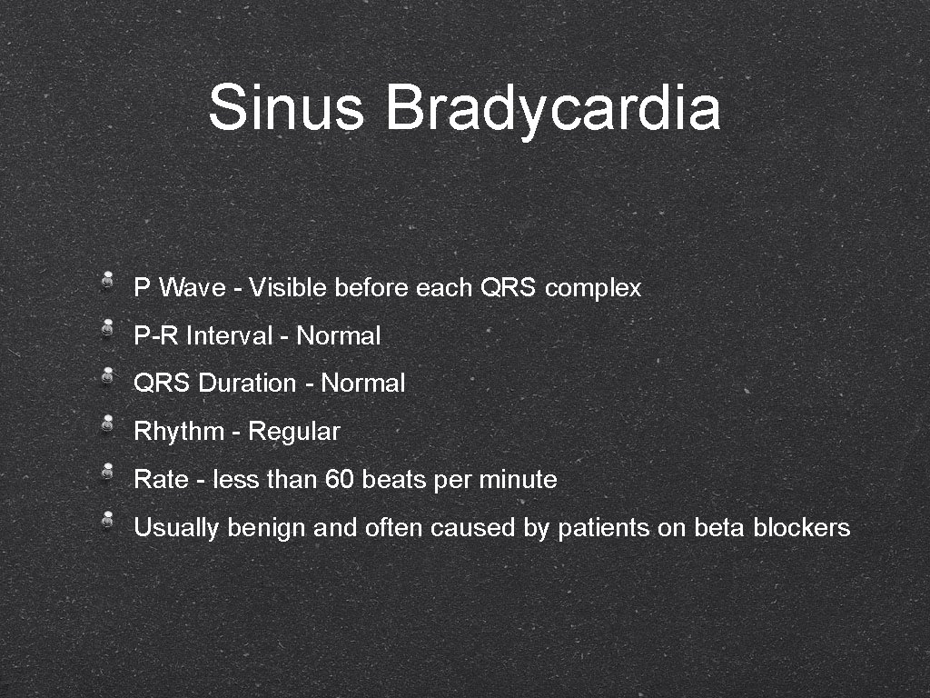 Sinus Bradycardia P Wave - Visible before each QRS complex P-R Interval - Normal