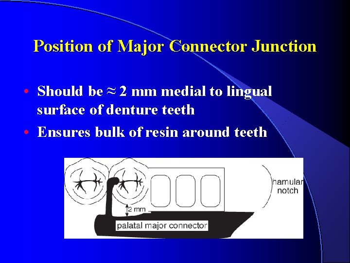 Position of Major Connector Junction • Should be ≈ 2 mm medial to lingual Position of Major Connector Junction • Should be ≈ 2 mm medial to lingual