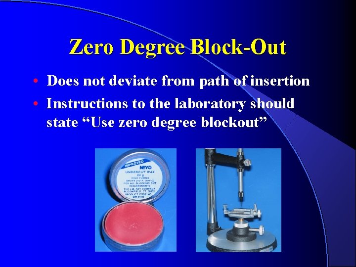 Zero Degree Block-Out • Does not deviate from path of insertion • Instructions to Zero Degree Block-Out • Does not deviate from path of insertion • Instructions to