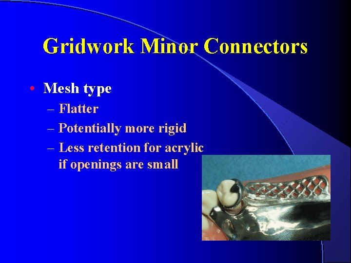 Gridwork Minor Connectors • Mesh type – Flatter – Potentially more rigid – Less Gridwork Minor Connectors • Mesh type – Flatter – Potentially more rigid – Less