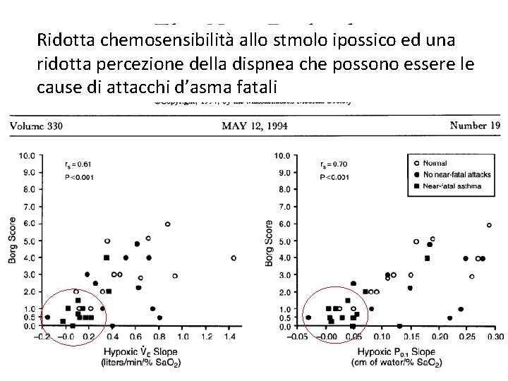 Ridotta chemosensibilità allo stmolo ipossico ed una ridotta percezione della dispnea che possono essere