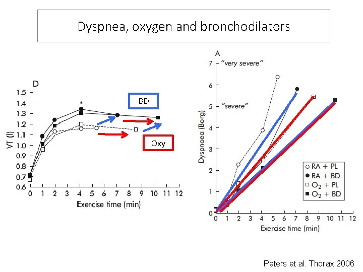 Dyspnea, oxygen and bronchodilators BD Oxy Peters et al. Thorax 2006 