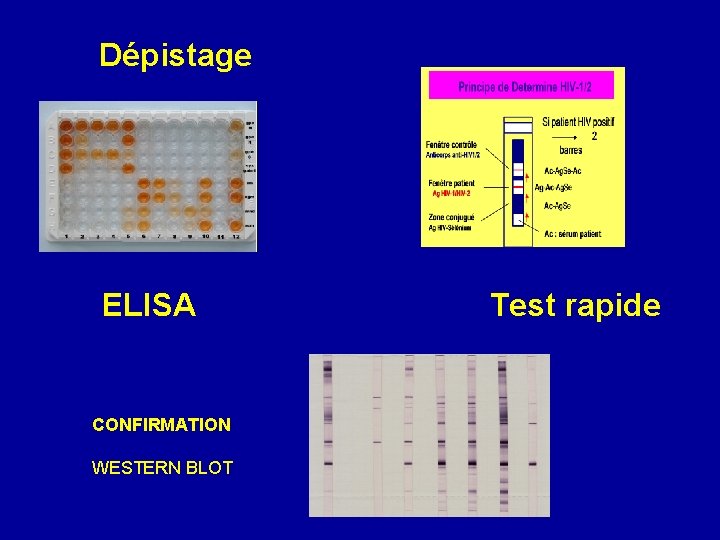 Dépistage ELISA CONFIRMATION WESTERN BLOT Test rapide 