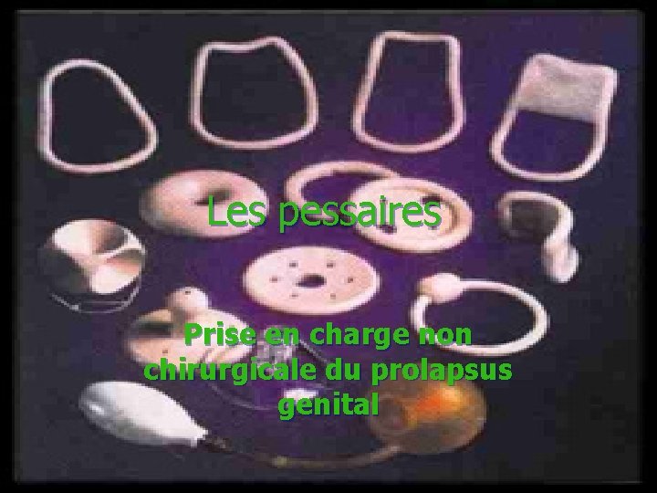 Les pessaires Prise en charge non chirurgicale du prolapsus genital 