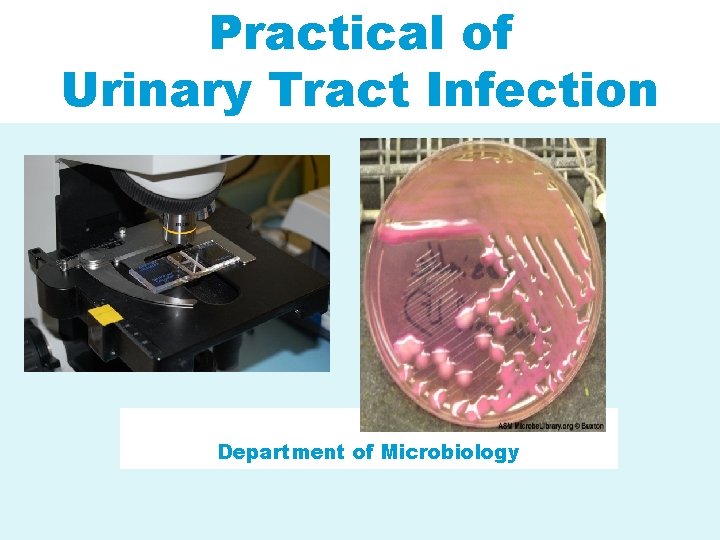 Practical of Urinary Tract Infection Department of Microbiology 