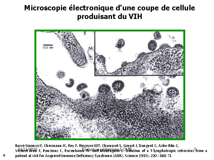 Microscopie électronique d'une coupe de cellule produisant du VIH 8 Barré-Sinoussi F, Chermann JC,