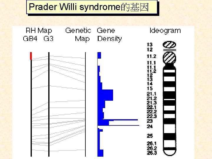 Prader Willi syndrome的基因 