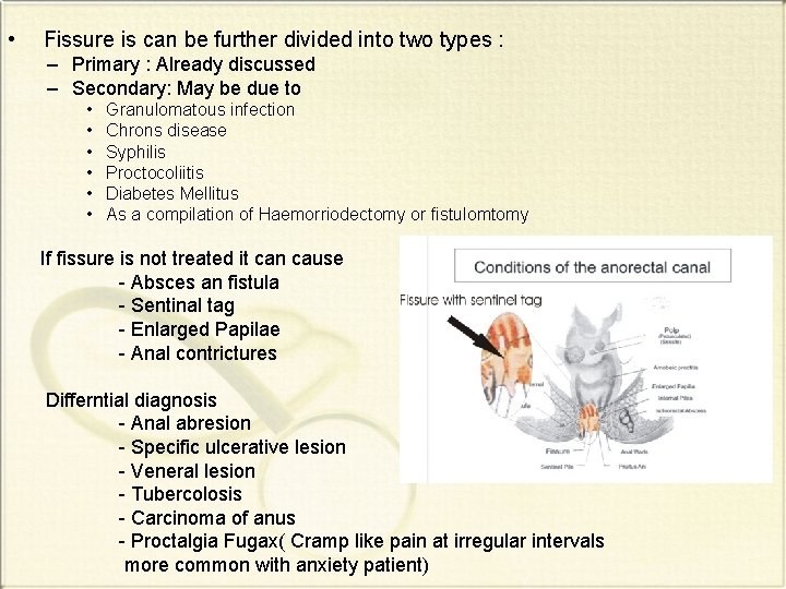  • Fissure is can be further divided into two types : – Primary